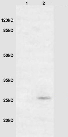 Western blot - Anti-RASSF3 antibody (AB204117)