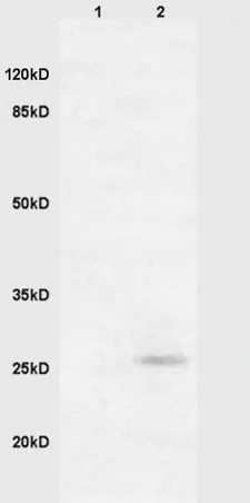 Western blot - Anti-RASSF3 antibody (AB204117)