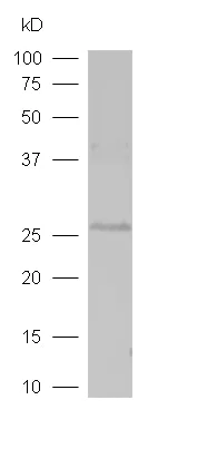 Western blot - Anti-RASSF3 antibody (AB204117)