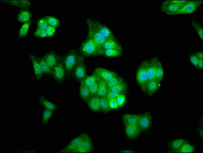 Immunocytochemistry/ Immunofluorescence - Anti-RASSF7 antibody (AB237617)