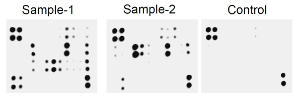 Rat AKI Antibody Array - Membrane (7 Targets)