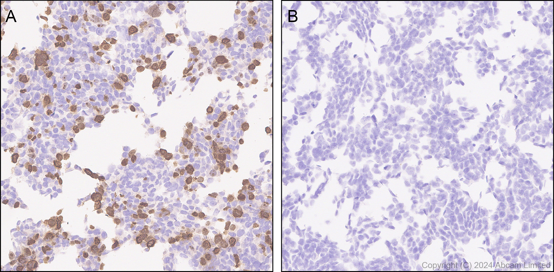 Immunohistochemistry (Formalin/PFA-fixed paraffin-embedded sections) - Anti-Rat Poly PR antibody [PERA534G] (AB323367), expandable thumbnail