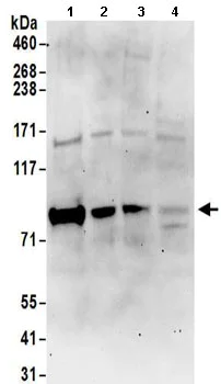Western blot - Anti-RAVER1 antibody (AB157131)