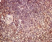 Immunohistochemistry (Formalin/PFA-fixed paraffin-embedded sections) - Anti-RAVER2 antibody [EPR12601] - BSA and Azide free (AB249817)
