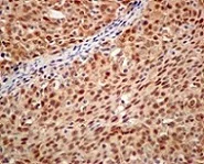 Immunohistochemistry (Formalin/PFA-fixed paraffin-embedded sections) - Anti-RAVER2 antibody [EPR12601] - BSA and Azide free (AB249817)