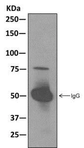 Immunoprecipitation - Anti-RAVER2 antibody [EPR12601] - BSA and Azide free (AB249817)