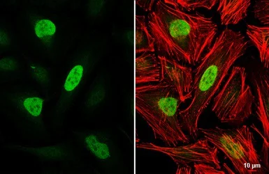 Immunocytochemistry/ Immunofluorescence - Anti-Rb antibody (AB226979)