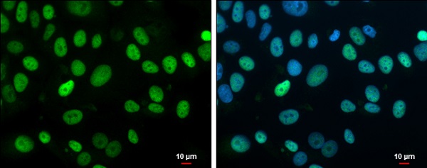 Immunohistochemistry (Formalin/PFA-fixed paraffin-embedded sections) - Anti-Rb antibody (AB226979), expandable thumbnail