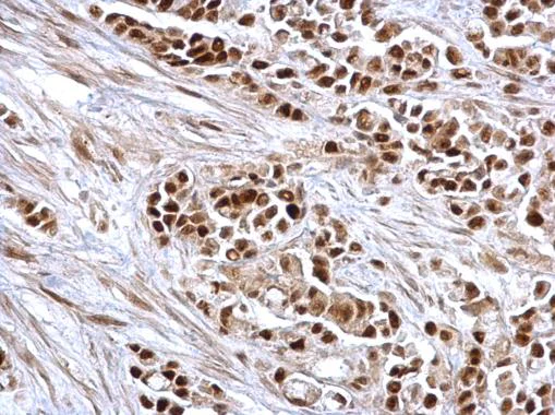 Immunohistochemistry (Formalin/PFA-fixed paraffin-embedded sections) - Anti-Rb antibody (AB226979)
