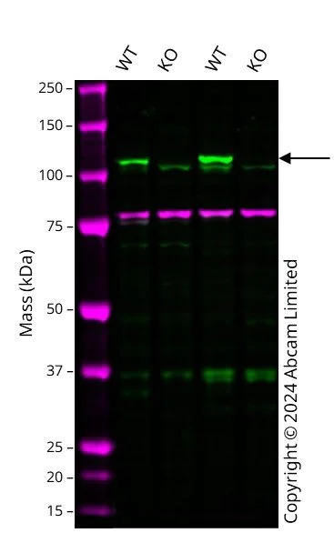 Western blot - Anti-Rb antibody (AB226979)
