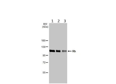 Western blot - Anti-Rb antibody (AB226979)