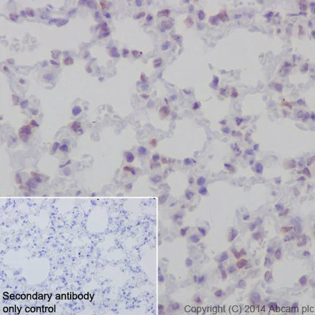 Immunohistochemistry (Formalin/PFA-fixed paraffin-embedded sections) - Anti-Rb antibody [EPR17512] (AB181616)