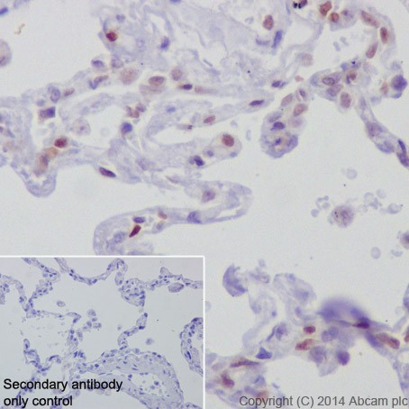 Immunohistochemistry (Formalin/PFA-fixed paraffin-embedded sections) - Anti-Rb antibody [EPR17512] (AB181616), expandable thumbnail