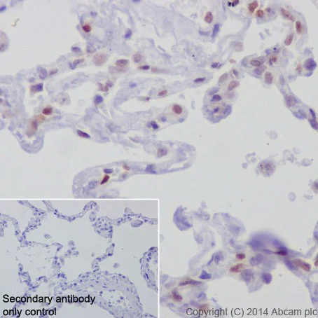 Immunohistochemistry (Formalin/PFA-fixed paraffin-embedded sections) - Anti-Rb antibody [EPR17512] (AB181616)