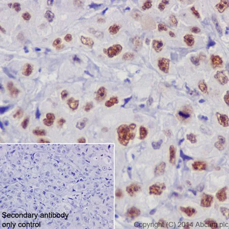 Immunohistochemistry (Formalin/PFA-fixed paraffin-embedded sections) - Anti-Rb antibody [EPR17512] (AB181616)