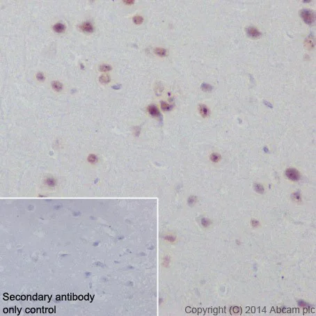 Immunohistochemistry (Formalin/PFA-fixed paraffin-embedded sections) - Anti-Rb antibody [EPR17512] (AB181616)