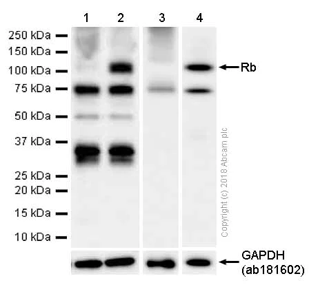 Western blot - Anti-Rb antibody [EPR17512] (AB181616)