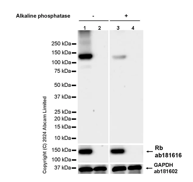 Western blot - Anti-Rb antibody [EPR17512] (AB181616)