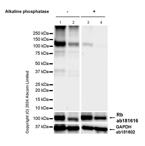 Western blot - Anti-Rb antibody [EPR17512] (ab181616), expandable thumbnail