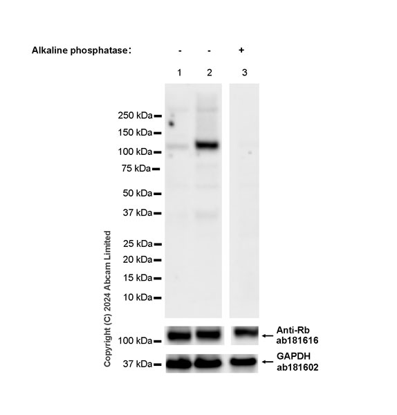 Western blot - Anti-Rb antibody [EPR17512] (ab181616), expandable thumbnail