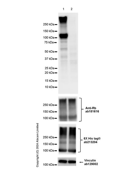 Western blot - Anti-Rb antibody [EPR17512] (ab181616), expandable thumbnail
