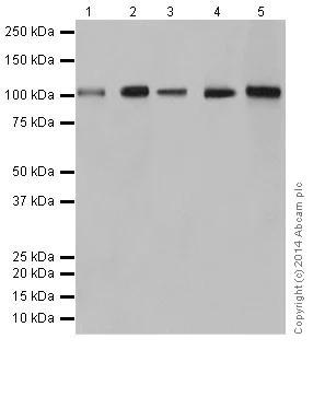 Western blot - Anti-Rb antibody [EPR17512] (AB181616)