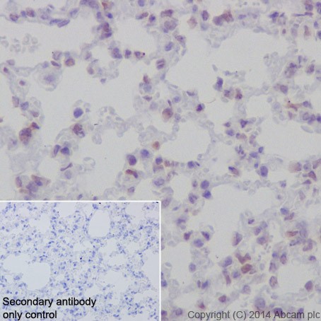 Immunohistochemistry (Formalin/PFA-fixed paraffin-embedded sections) - Anti-Rb antibody [EPR17512] - BSA and Azide free (ab218526), expandable thumbnail