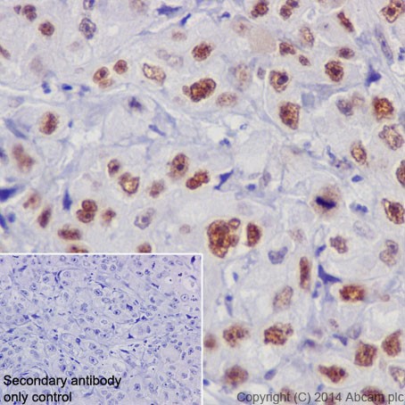 Immunohistochemistry (Formalin/PFA-fixed paraffin-embedded sections) - Anti-Rb antibody [EPR17512] - BSA and Azide free (AB218526), expandable thumbnail