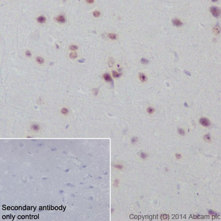 Immunohistochemistry (Formalin/PFA-fixed paraffin-embedded sections) - Anti-Rb antibody [EPR17512] - BSA and Azide free (ab218526), expandable thumbnail
