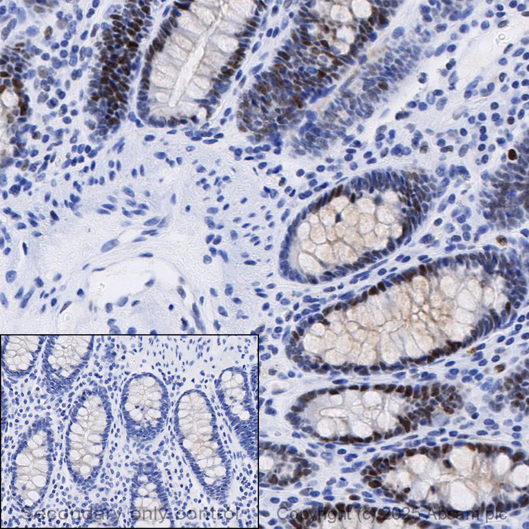 Immunohistochemistry (Formalin/PFA-fixed paraffin-embedded sections) - Anti-Rb antibody [EPR17512] - BSA and Azide free (AB218526)