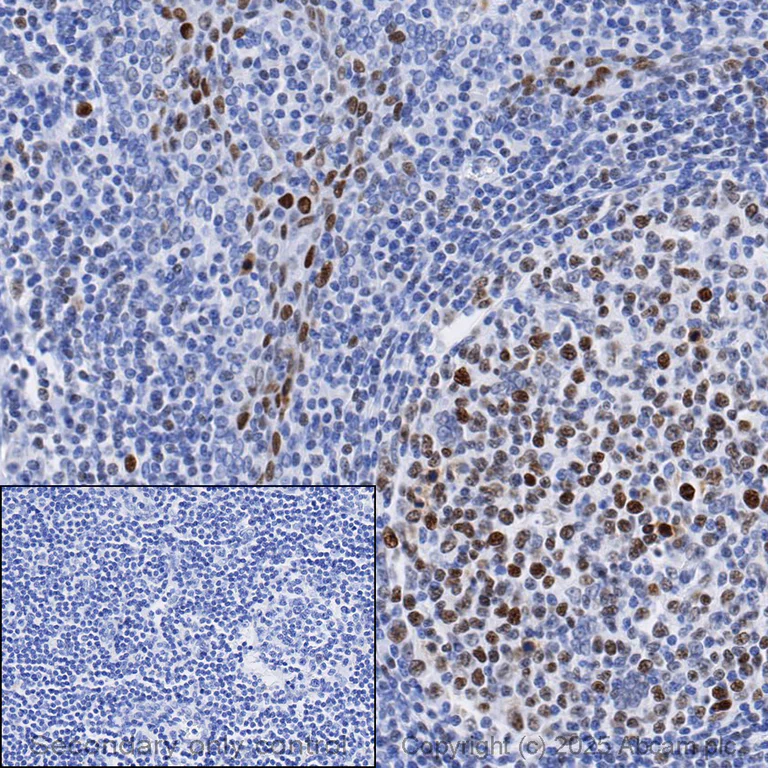 Immunohistochemistry (Formalin/PFA-fixed paraffin-embedded sections) - Anti-Rb antibody [EPR17512] - BSA and Azide free (AB218526)