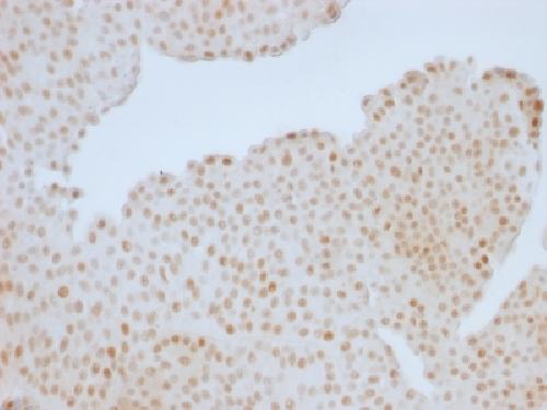 Immunohistochemistry (Formalin/PFA-fixed paraffin-embedded sections) - Anti-Rb antibody [RB1/1754] (AB218506), expandable thumbnail
