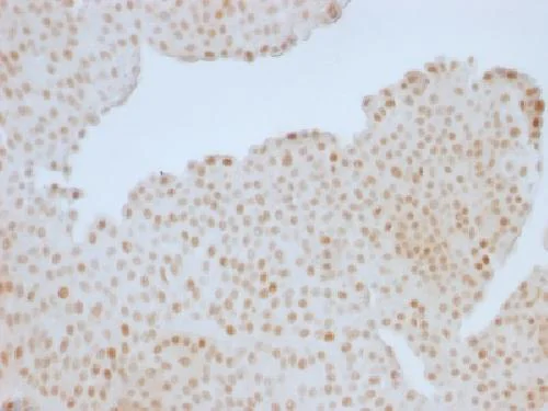 Immunohistochemistry (Formalin/PFA-fixed paraffin-embedded sections) - Anti-Rb antibody [RB1/1754] (AB218506)
