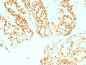 Immunohistochemistry (Formalin/PFA-fixed paraffin-embedded sections) - Anti-Rb antibody [RB1/1754] (AB218506)