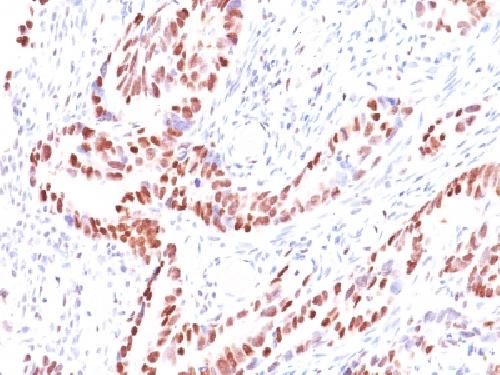 Immunohistochemistry (Formalin/PFA-fixed paraffin-embedded sections) - Anti-Rb antibody [SPM353] (AB218505), expandable thumbnail