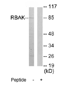 Western blot - Anti-RB associated KRAB repressor antibody (AB72609)