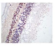 Immunohistochemistry (Formalin/PFA-fixed paraffin-embedded sections) - Anti-Rb (phospho S608) antibody [EPR10849] (AB172975), expandable thumbnail