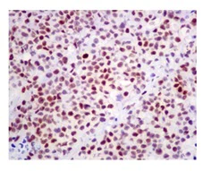 Immunohistochemistry (Formalin/PFA-fixed paraffin-embedded sections) - Anti-Rb (phospho S608) antibody [EPR10849] (AB172975)