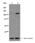 Western blot - Anti-Rb (phospho S608) antibody [EPR10849] (AB172975), expandable thumbnail