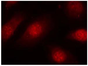 Immunocytochemistry/ Immunofluorescence - Anti-Rb (phospho S780) antibody (AB131264), expandable thumbnail