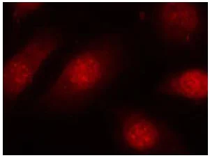 Immunocytochemistry/ Immunofluorescence - Anti-Rb (phospho S780) antibody (AB131264)