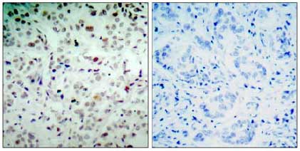 Immunohistochemistry (Formalin/PFA-fixed paraffin-embedded sections) - Anti-Rb (phospho S780) antibody (AB131264), expandable thumbnail