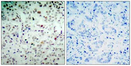 Immunohistochemistry (Formalin/PFA-fixed paraffin-embedded sections) - Anti-Rb (phospho S780) antibody (AB131264)