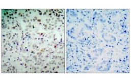 Immunohistochemistry (Formalin/PFA-fixed paraffin-embedded sections) - Anti-Rb (phospho S780) antibody (AB47763), expandable thumbnail