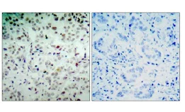 Immunohistochemistry (Formalin/PFA-fixed paraffin-embedded sections) - Anti-Rb (phospho S780) antibody (AB47763)