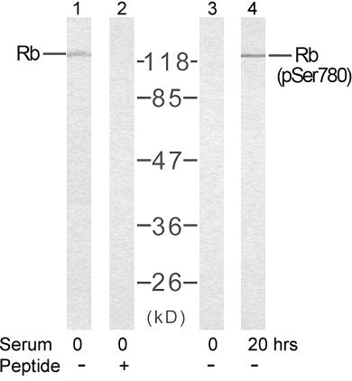 Western blot - Anti-Rb (phospho S780) antibody (AB47763), expandable thumbnail