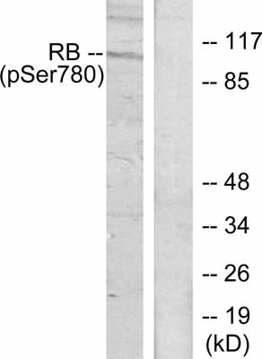 Western blot - Anti-Rb (phospho S780) antibody (AB47763), expandable thumbnail