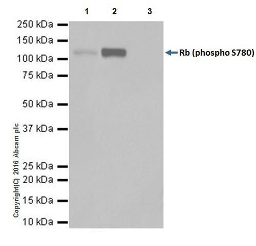 Immunoprecipitation - Anti-Rb (phospho S780) antibody [EPR17624] (AB184702)