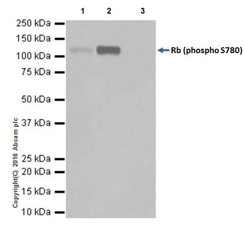 Immunoprecipitation - Anti-Rb (phospho S780) antibody [EPR17624] - BSA and Azide free (AB250774)