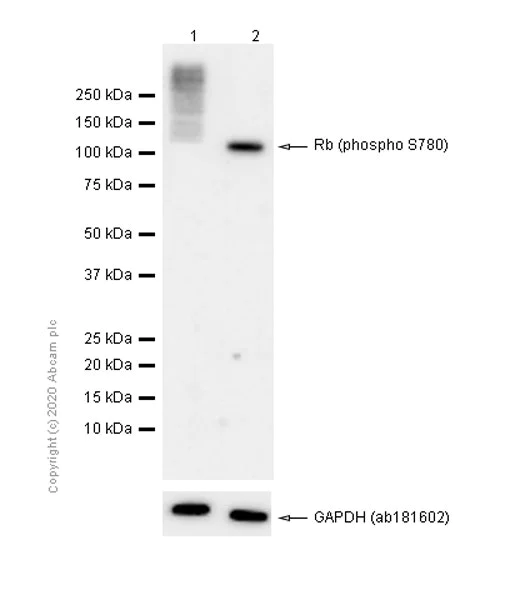 Western blot - Anti-Rb (phospho S780) antibody [EPR17624] - BSA and Azide free (AB250774)